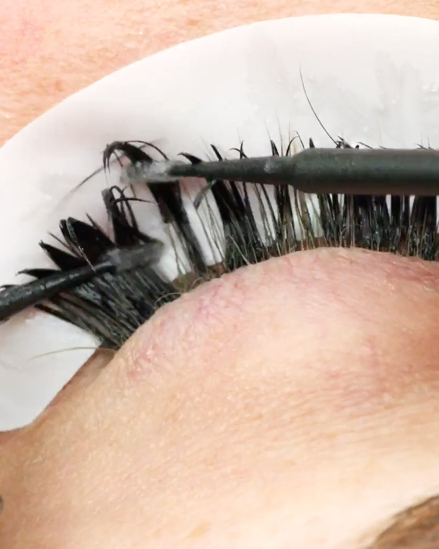 Adhesive Remover Gel